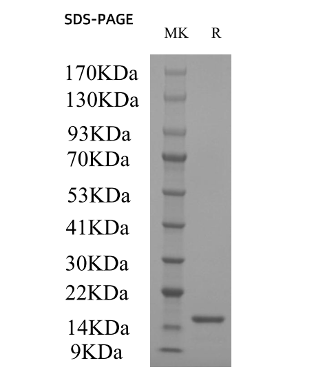 Recombinant Human FGF-basic (154 a.a.)