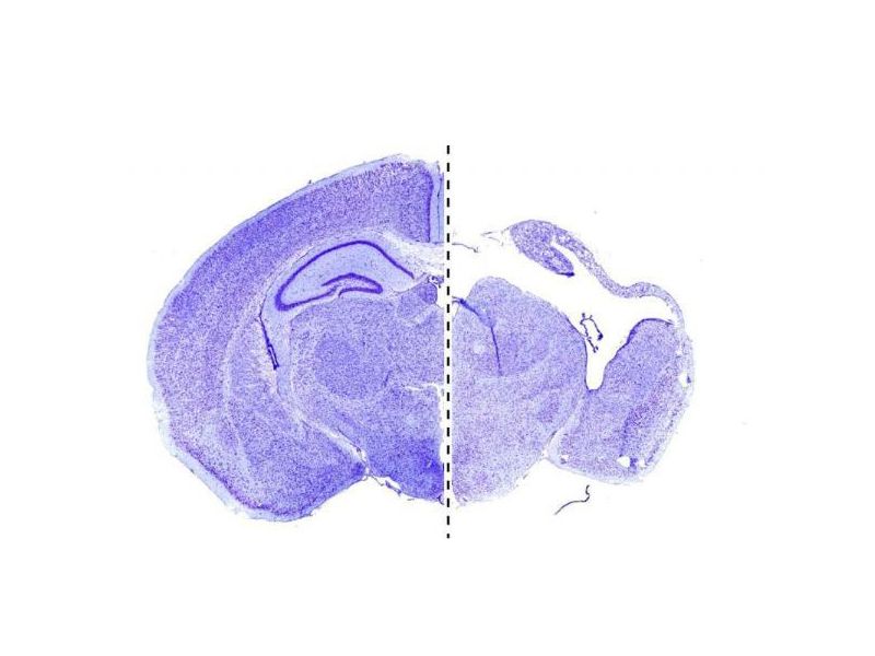 Read more about the article 研究人员发现了导致大脑发育缺陷的关键基因