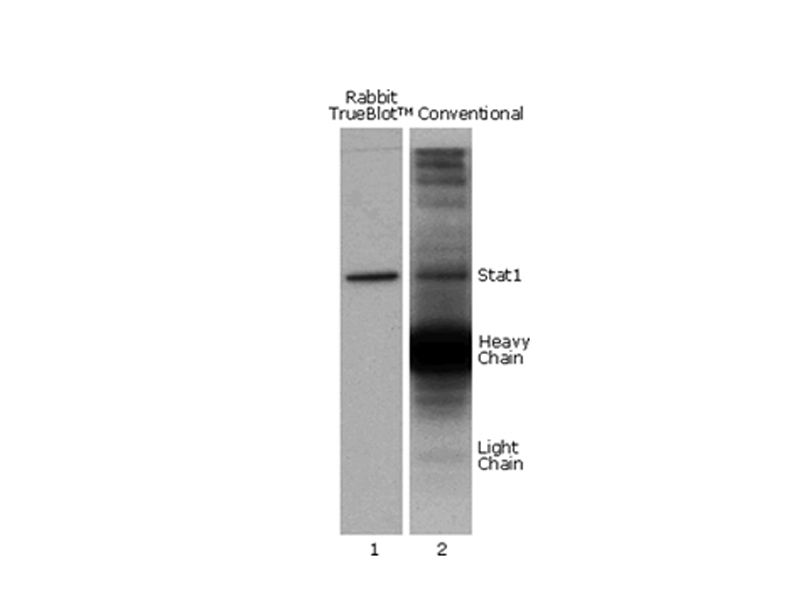 Read more about the article TrueBlot——特殊二抗